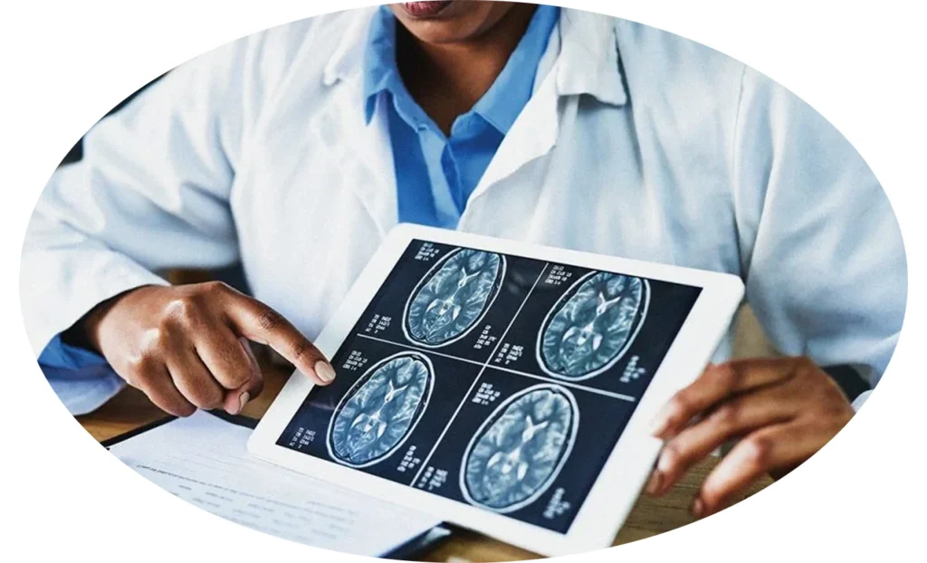 Multiple Sclerosis Treatment in Pune