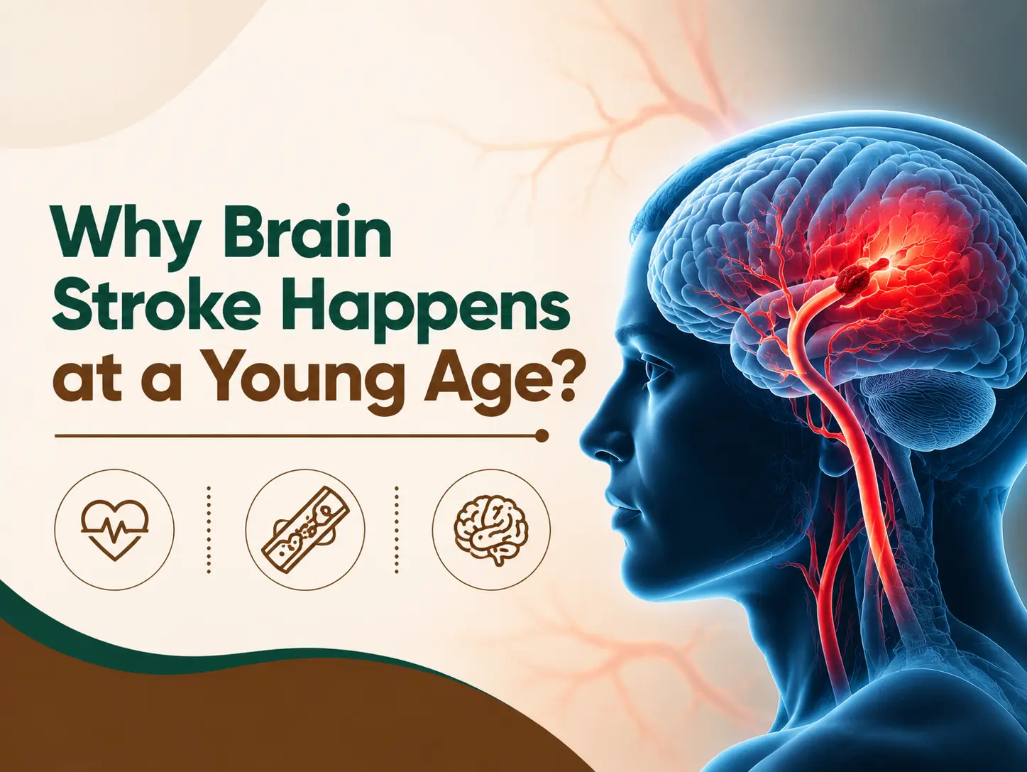 Illustration titled Why Brain Stroke Happens at a Young Age, showing a clot blocking a blood vessel in the brain